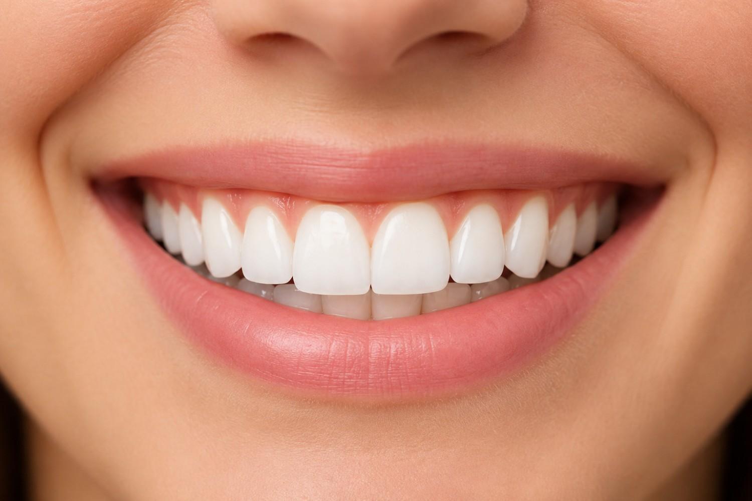 Can i have my teeth whitened if i have sensitive teeth